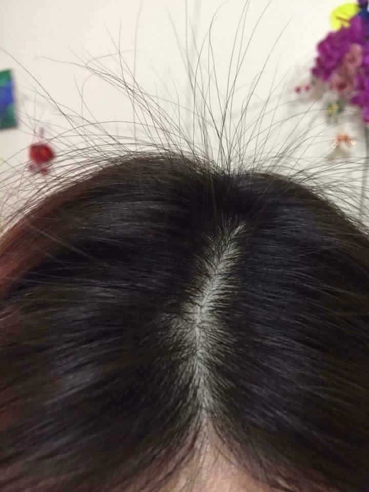 Tôi Đã Lấy Lại Được Mái Tóc Đen Bóng Nhờ Hà Thủ Ô Đậu Đen
