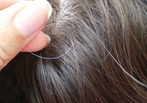 Hà thủ ô có thể chữa được chứng tóc bạc sớm