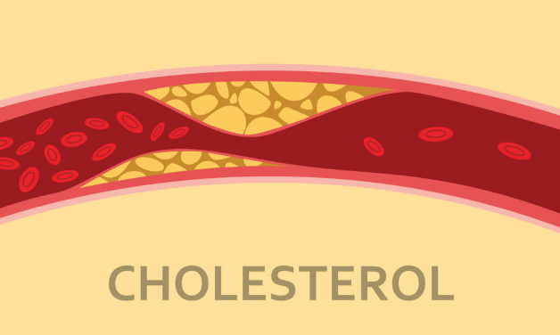 Đào thải cholesterol xấu và mỡ máu giúp giảm cân hiệu quả